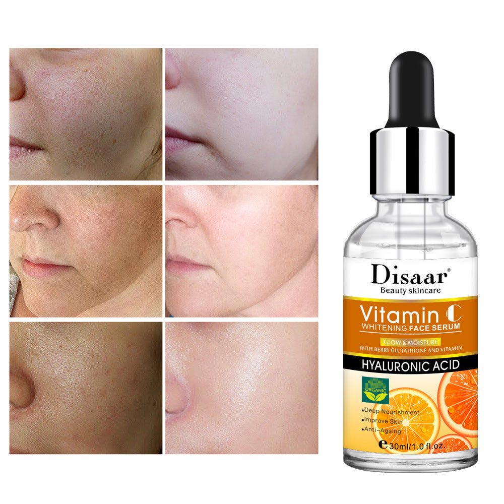 Vitamin C Face Whitening Serum